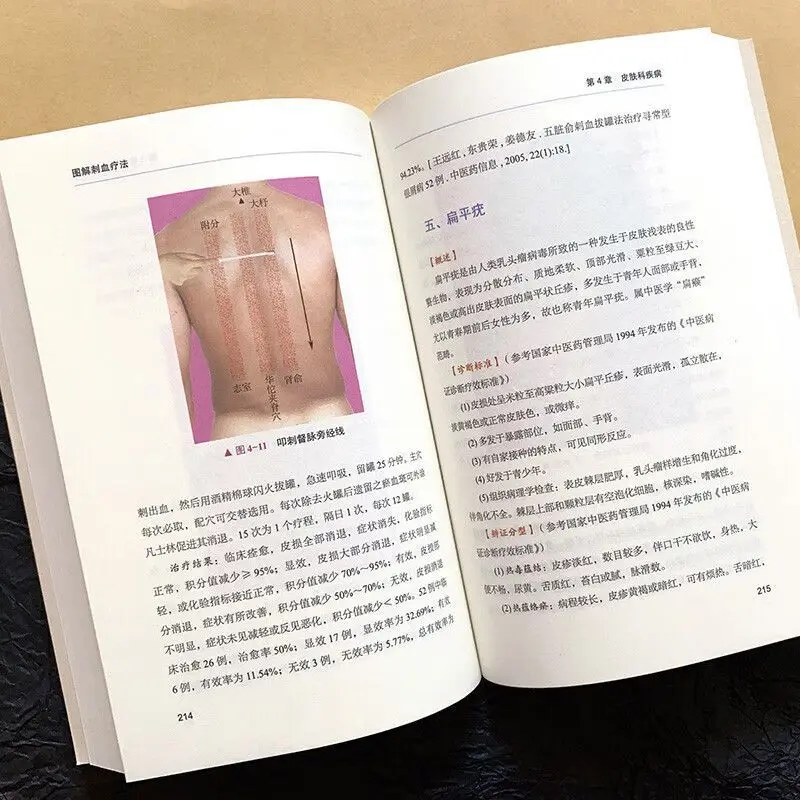 「放血療法」について解説：健康とウェルネスのための伝統中国医 - Therapy Health And Wellness のレビューと価格